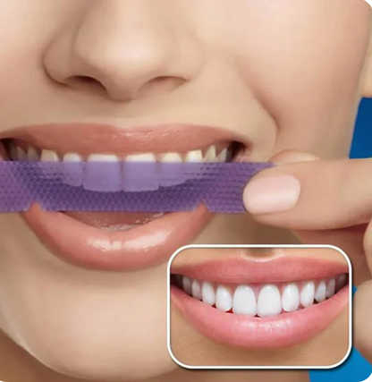 Bandes blanchiment  V34